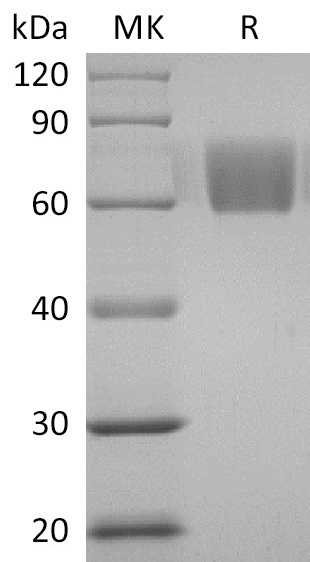 Human CD98 +SDS-PAGE-2.jpg